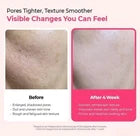 Dr. Melaxin Lumi Firm &amp; Lift Duo – Cyano Pink Spicule &amp; Picotonic Korean Skincare